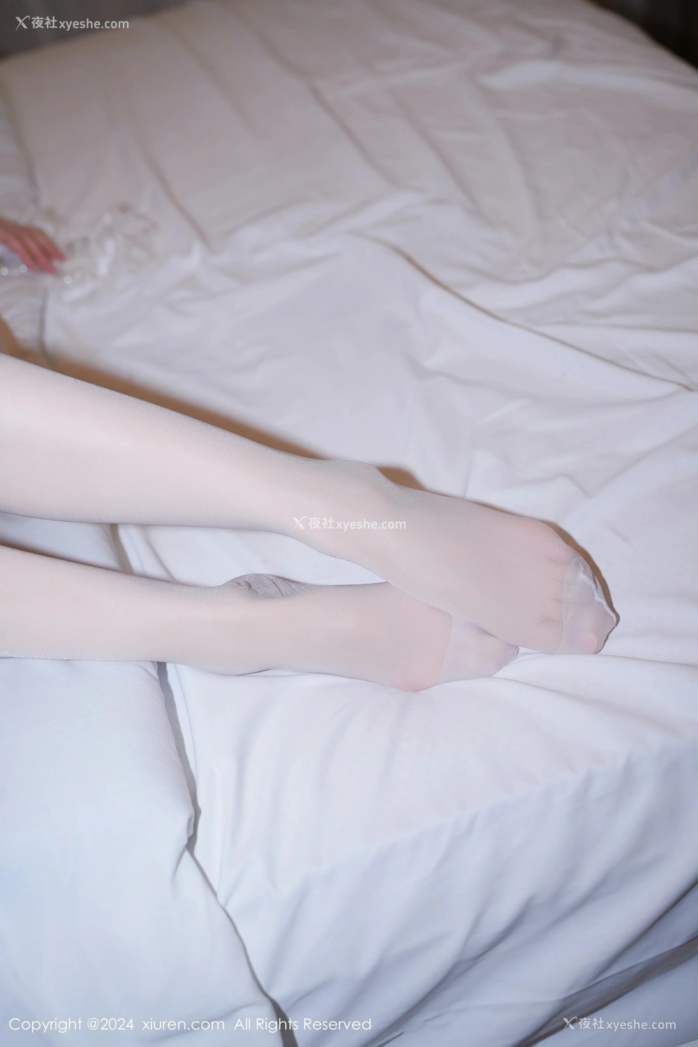 1P - [XiuRen秀人网] No.8344 林月月
