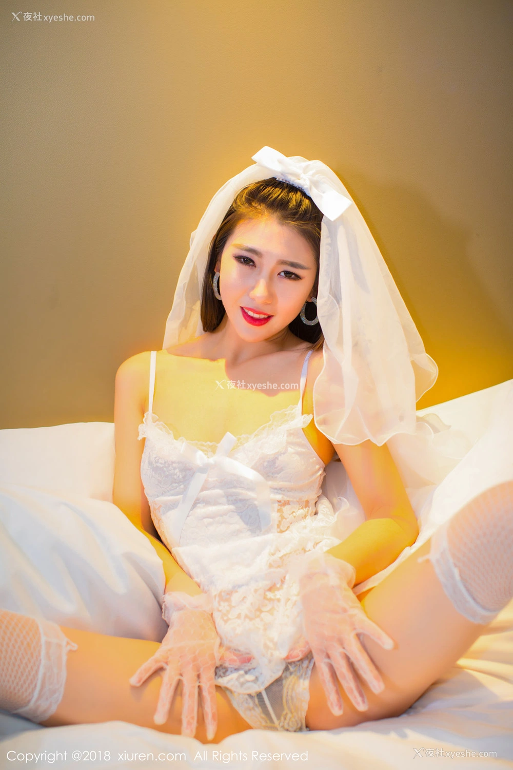 1P - [秀人网]美媛馆No.896 糖果儿