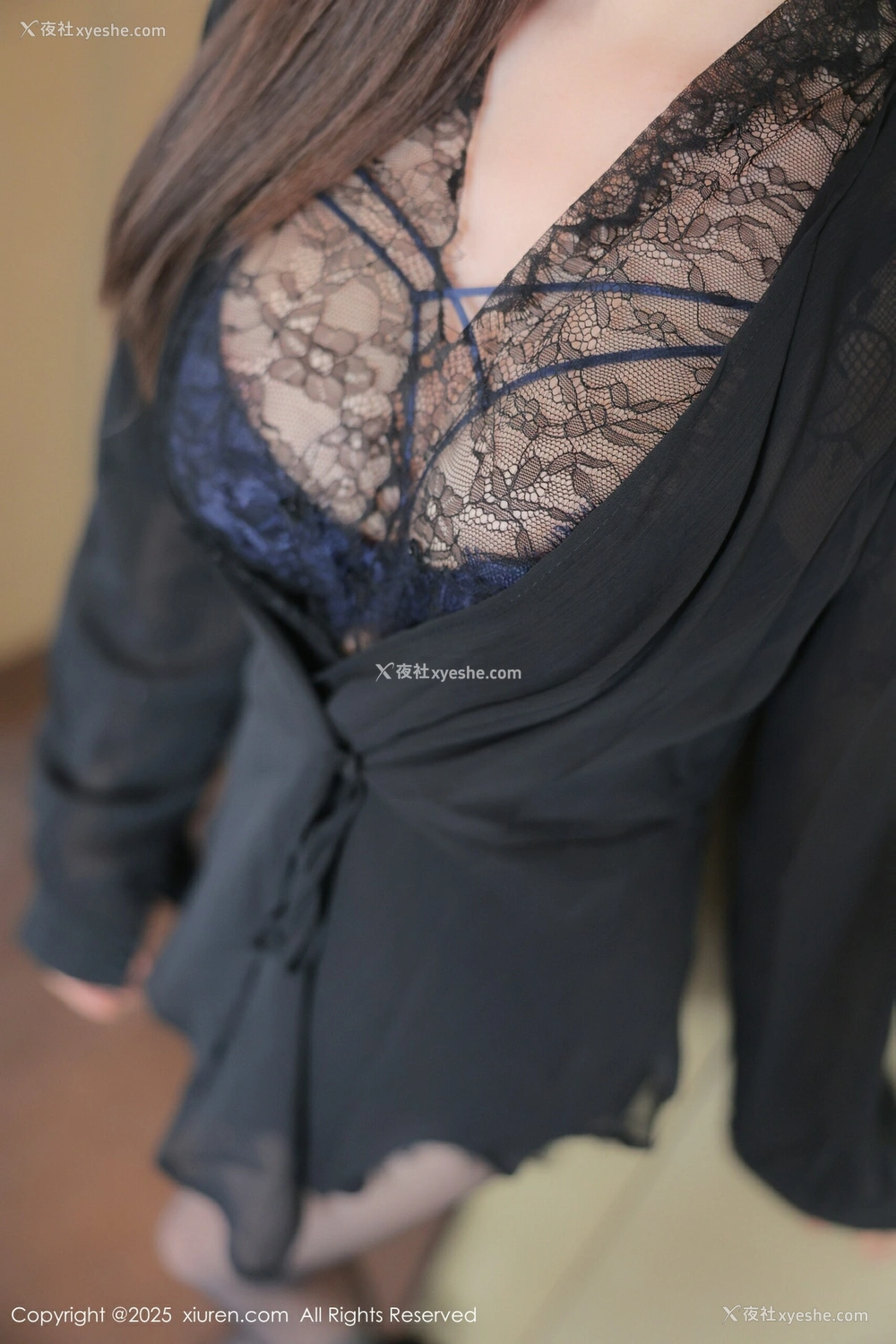 1P - [XiuRen秀人网] No.10382 Annie_baby [73P]