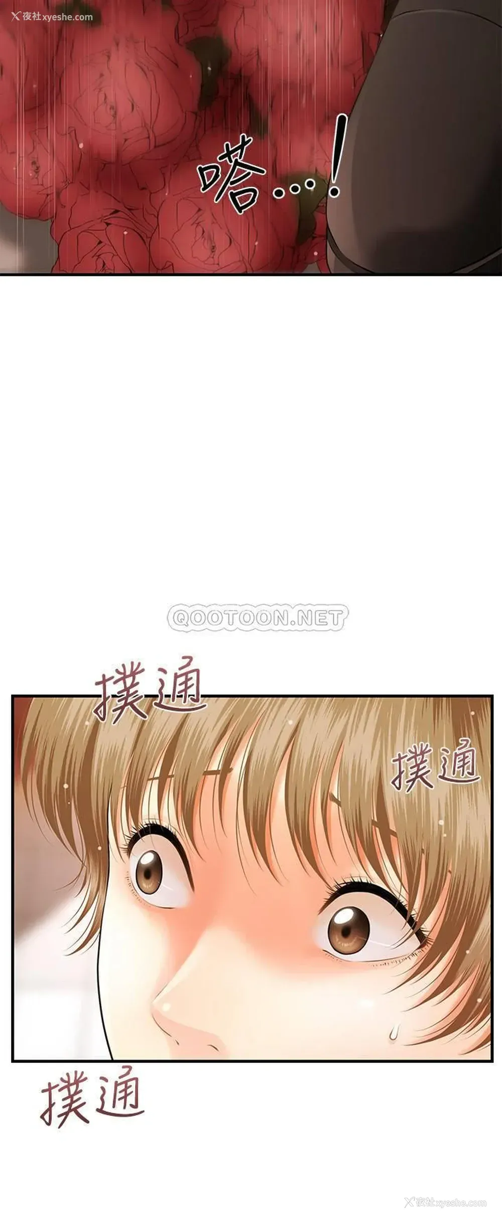 23P - 医美奇鸡