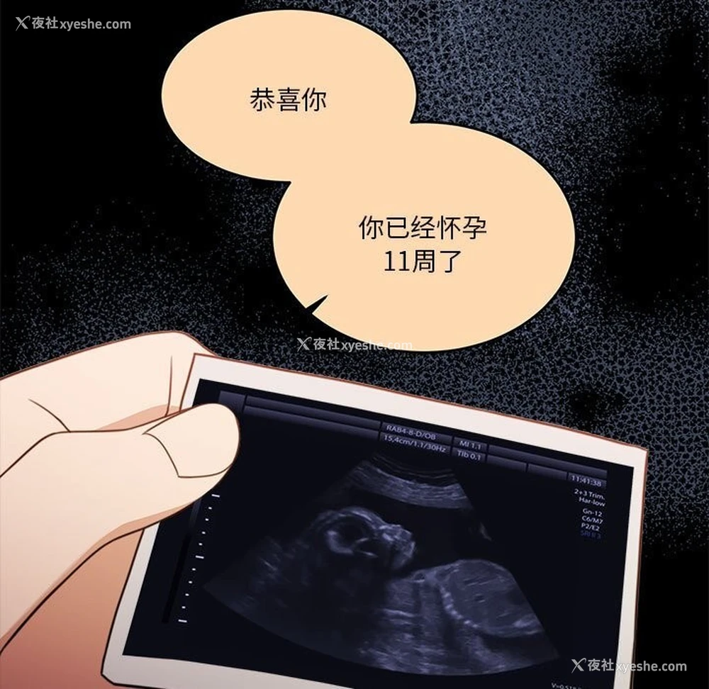 91P - 怀孕契约